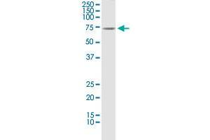 CLU monoclonal antibody (M01), clone 1A11. (Clusterin 抗体  (AA 402-501))