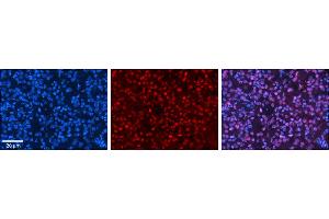 Rabbit Anti-HIPK2 Antibody     Formalin Fixed Paraffin Embedded Tissue: Human Pineal Tissue  Observed Staining: Nuclear in pinealocytes & intersticial cells  Primary Antibody Concentration: 1:100  Other Working Concentrations: 1/600  Secondary Antibody: Donkey anti-Rabbit-Cy3  Secondary Antibody Concentration: 1:200  Magnification: 20X  Exposure Time: 0. (HIPK2 抗体  (Middle Region))