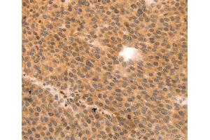 Immunohistochemistry (IHC) image for anti-Myosin Regulatory Light Polypeptide 9 (MYL9) (AA 1-100) antibody (ABIN3023463) (MYL9 抗体  (AA 1-100))