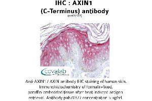 Image no. 1 for anti-Axin 1 (AXIN1) (C-Term) antibody (ABIN1732155) (Axin 抗体  (C-Term))