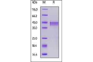 SDS-PAGE (SDS) image for Connective Tissue Growth Factor (CTGF) (AA 27-349) protein (His tag,AVI tag,Biotin) (ABIN7013364)