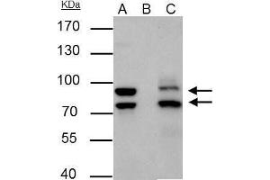 IP Image MDM2 antibody immunoprecipitates MDM2 protein in IP experiments.