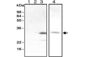 Western blot analysis of recombinant human AK isozymes. (Adenylate Kinase 3 抗体)