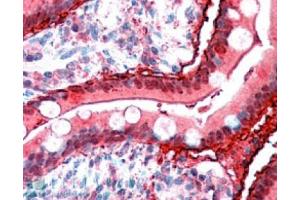 Image no. 1 for anti-Fatty Acid Binding Protein 2, Intestinal (FABP2) (C-Term) antibody (ABIN374817) (FABP2 抗体  (C-Term))