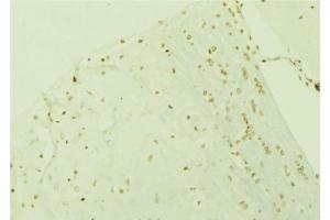 ABIN6276619 at 1/100 staining Mouse brain tissue by IHC-P. (STIP1 抗体  (N-Term))
