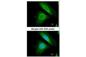 ICC/IF Image Immunofluorescence analysis of paraformaldehyde-fixed HeLa, using Optineurin, antibody at 1:200 dilution. (OPTN 抗体)