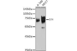 Western blot analysis of extracts of various cell lines, using 5T4 Rabbit mAb (ABIN7271009) at 1:1000 dilution. (TPBG 抗体)