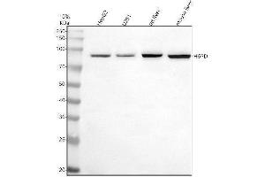 Western blot analysis of H6PD using anti-H6PD antibody (ABIN7825406).