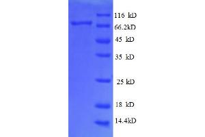 SDS-PAGE (SDS) image for Ribophorin 1 (RPN1) (AA 44-427), (partial) protein (GST tag) (ABIN5712385)