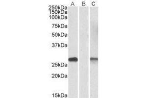 Lane A: DYDC1 Antibody staining of HEK293 overexpressing Human DYDC1 lysate at 1µg/ml (10µg protein in RIPA buffer).
