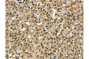 ABIN6260516 and ABIN6267035 at 1/100 staining Rat ovarian tissue by IHC-P.