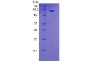 SDS-PAGE analysis of Human MBL2 Protein. (MBL2 蛋白)