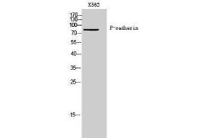 Western Blotting (WB) image for anti-P-Cadherin (CDH3) (N-Term) antibody (ABIN3180797) (P-Cadherin 抗体  (N-Term))