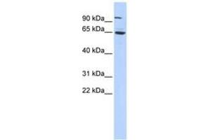 Image no. 1 for anti-Forkhead Box J3 (FOXJ3) (C-Term) antibody (ABIN6742827) (FOXJ3 抗体  (C-Term))
