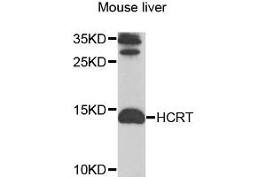 Western blot analysis of extracts of mouse liver cells, using HCRT antibody. (Orexin 抗体)