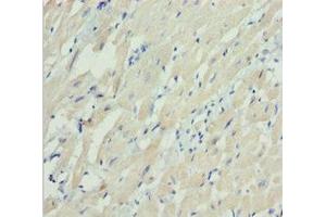 Immunohistochemistry of paraffin-embedded human heart tissue using ABIN7160533 at dilution of 1:100 (MYL3/CMLC1 抗体  (AA 1-195))
