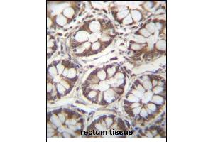 LAD1 Antibody (N-term) (ABIN656787 and ABIN2846006) immunohistochemistry analysis in formalin fixed and paraffin embedded human rectum tissue followed by peroxidase conjugation of the secondary antibody and DAB staining. (Ladinin 1 抗体  (N-Term))