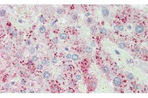 Detection of ORM2 in Human Liver Tissue using Polyclonal Antibody to Orosomucoid 2 (ORM2) (Orosomucoid 2 抗体  (AA 19-207))