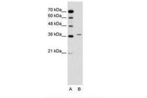 Image no. 1 for anti-Aminolevulinate Dehydratase (ALAD) (AA 91-140) antibody (ABIN6736618) (ALAD 抗体  (AA 91-140))
