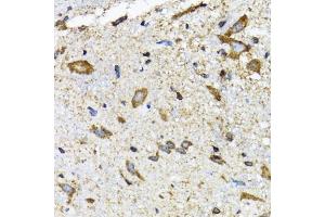 Immunohistochemistry of paraffin-embedded mouse spinal cord using SLC23A2 antibody (ABIN5974077) at dilution of 1/100 (40x lens). (SLC23A2 抗体)