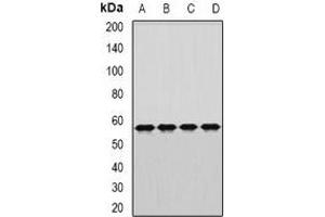 Western blot analysis of DARS expression in MCF7 (A), SW480 (B), mouse brain (C), rat liver (D) whole cell lysates. (DARS 抗体)