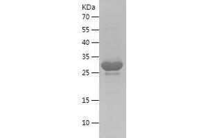 Western Blotting (WB) image for Aquaporin 4 (AQP4) (AA 253-323) protein (His-IF2DI Tag) (ABIN7283413) (Aquaporin 4 Protein (AQP4) (AA 253-323) (His-IF2DI Tag))