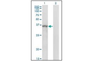 Western Blotting (WB) image for anti-Sprouty Homolog 1, Antagonist of FGF Signaling (SPRY1) antibody (ABIN781897) (SPRY1 抗体)