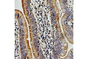 Immunohistochemistry (IHC) image for anti-Pregnancy Specific beta-1-Glycoprotein 1 (PSG1) antibody (ABIN7308238) (PSG1 抗体)