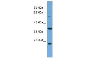 MIER2 antibody used at 0. (MIER2 抗体  (Middle Region))