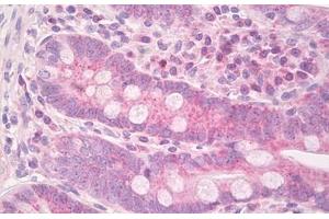 Image no. 2 for anti-ISG15 Ubiquitin-Like Modifier (ISG15) (AA 80-129) antibody (ABIN6749770) (ISG15 抗体  (AA 80-129))