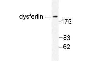 Image no. 1 for anti-Dysferlin (DYSF) antibody (ABIN265388) (Dysferlin 抗体)