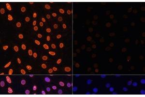Immunofluorescence analysis of C6 cells using Acetyl-Histone H3-K36 Polyclonal Antibody at dilution of 1:100.