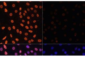 Immunofluorescence analysis of C6 cells using Acetyl-Histone H3-K36 Polyclonal Antibody at dilution of 1:100. (Histone 3 抗体  (acLys36))