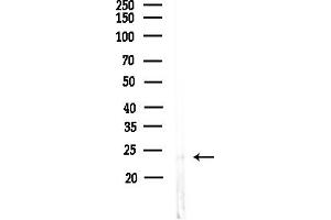 anti-Suppressor of IKBKE 1 (SIKE1) (C-Term) antibody