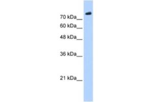 Western Blotting (WB) image for anti-PHD Finger Protein 20 (PHF20) antibody (ABIN2461244) (PHF20 抗体)
