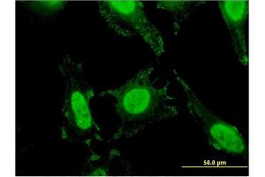 Immunofluorescence (IF) image for anti-Solute Carrier Family 4, Anion Exchanger, Member 1 (erythrocyte Membrane Protein Band 3, Diego Blood Group) (SLC4A1) (AA 261-360) antibody (ABIN520241)