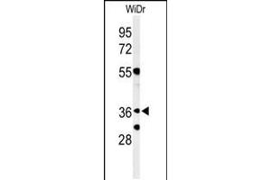 Western blot analysis of NSE4A Antibody in WiDr cell line lysates (35ug/lane) (NSMCE4A 抗体  (N-Term))