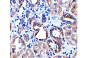 Immunohistochemistry of ACE2 in human kidney tissue with ACE2 polyclonal antibody  at 2 ug/mL . (ACE2 抗体  (Internal Region))