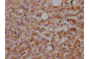 IHC image of ABIN7127599 diluted at 1:100 and staining in paraffin-embedded human liver tissue performed on a Leica BondTM system. (Recombinant LDLR 抗体)