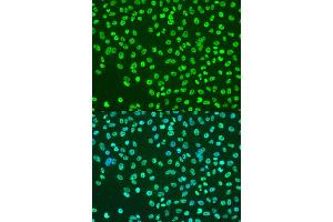 Immunofluorescence analysis of U2OS cells using Acetyl-Histone H3-K9 antibody (ABIN4903918) at dilution of 1:100.