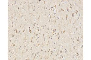 Immunohistochemistry analysis of paraffin-embedded rat brain using LC3A/B Polyclonal Antibody at dilution of 1:500. (LC3A / LC3B 抗体)