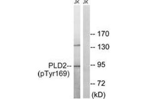 Western blot analysis of extracts from Jurkat cells treated with TNF 20ng/ml 30', using PLD2 (Phospho-Tyr169) Antibody. (Phospholipase D2 抗体  (pTyr169))