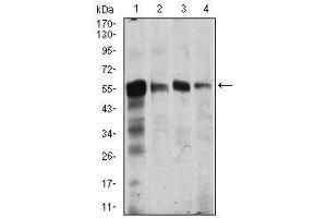 Image no. 4 for anti-Calcium/calmodulin-Dependent Protein Kinase IV (CAMK4) antibody (ABIN1491438) (CAMK4 抗体)