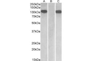 HEK293 lysate (10 µg protein in RIPA buffer) overexpressing Human Furin with C-terminal MYC tag probed with ABIN1590028 (1 µg/mL) in Lane A and probed with anti-MYC Tag (1/1000) in lane C. (FURIN 抗体  (Internal Region))