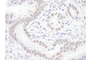 Immunohistochemistry (IHC) image for anti-Small Nuclear Ribonucleoprotein D3 Polypeptide 18kDa (SNRPD3) (AA 76-126) antibody (ABIN7454989)