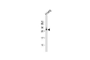 Anti-ELOVL6 Antibody (N-term) at 1:1000 dilution + human lung lysate Lysates/proteins at 20 μg per lane. (ELOVL6 抗体  (N-Term))