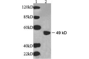 Western Blotting (WB) image for anti-UDP-Gal:betaGlcNAc beta 1,3-Galactosyltransferase, Polypeptide 2 (B3GALT2) antibody (ABIN244874) (B3GALT2 抗体)