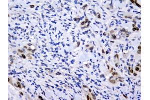 IHC analysis of Emerin using anti-Emerin antibody (ABIN5692852).