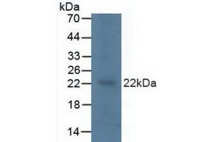 Detection of KRAS in Porcine Brain Tissue using Polyclonal Antibody to V-Ki-Ras2 Kirsten Rat Sarcoma Viral Oncogene Homolog (KRAS) (K-RAS 抗体  (AA 1-189))