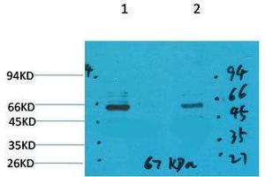 Western Blot (WB) analysis of 1) Mouse Brain Tissue, 2)Rat Brain Tissue with GABA Transporter 1 Rabbit Polyclonal Antibody diluted at 1:2000. (SLC6A1 抗体)